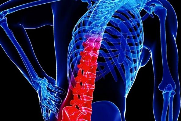 The reasons for the development of thoraxosteochondrosis
